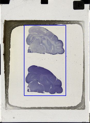 Media type: image; Special Collections 3043   shows specimen_part histological serial section;